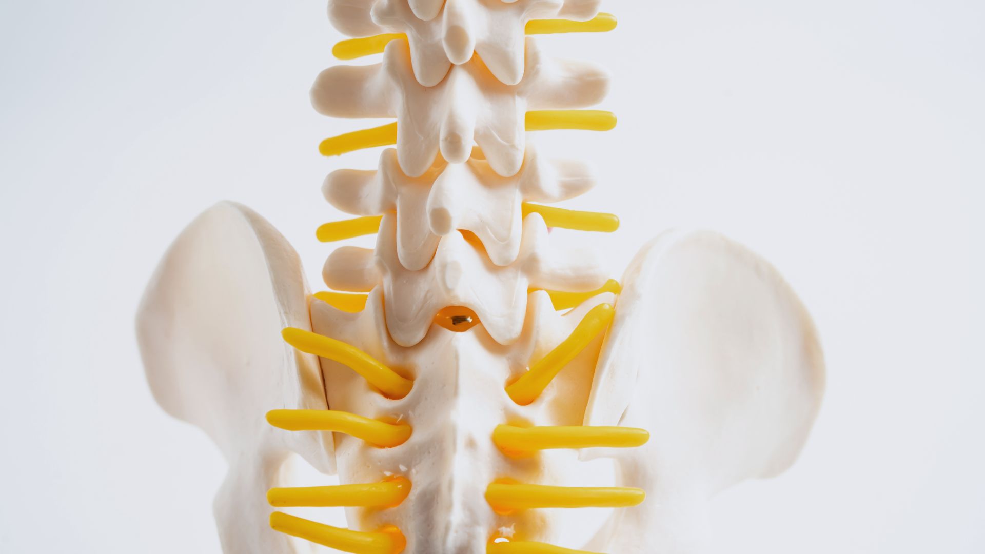 Herniated Discs and What Causes Them