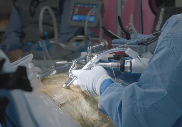 Endoscopic Spine Surgery in London - MSpine