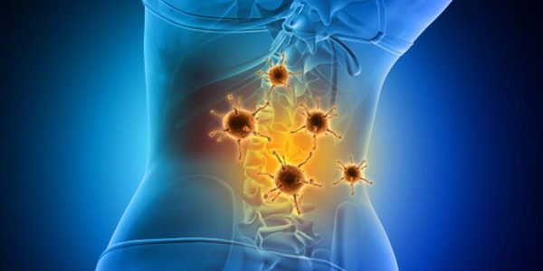 Spine Infection
