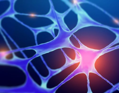 Spontaneous Intracranial Hypotension (SIH) - London Spine Health 2